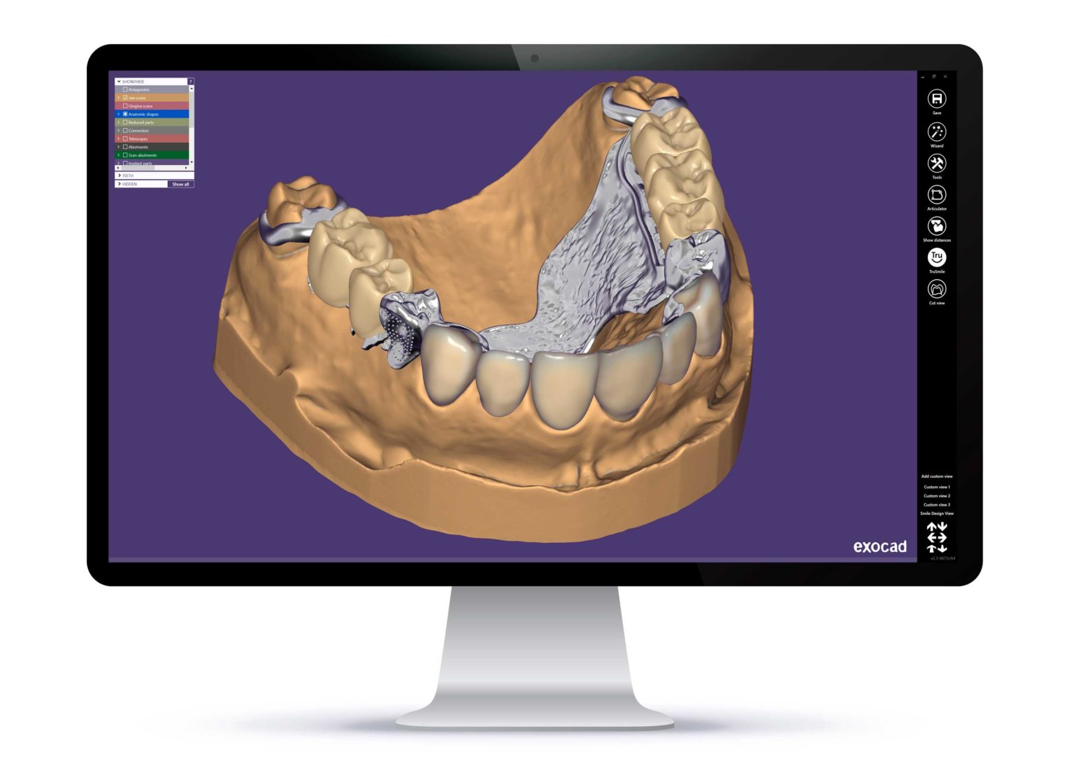 Laboratorio CAD/CAM: FLUJO 100% DIGITAL | Nanodent