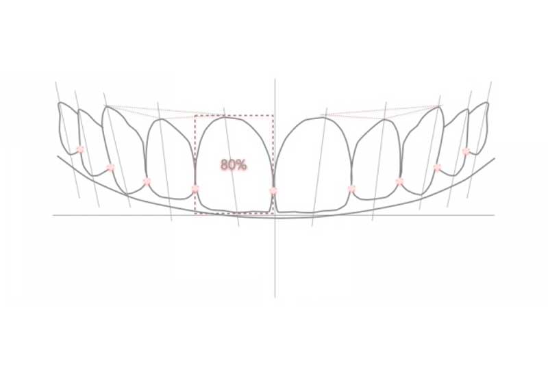 diseño digital de sonrisa