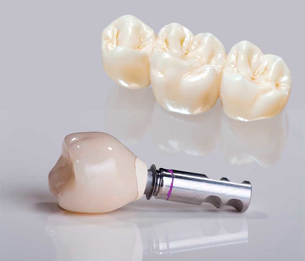 zirconia
